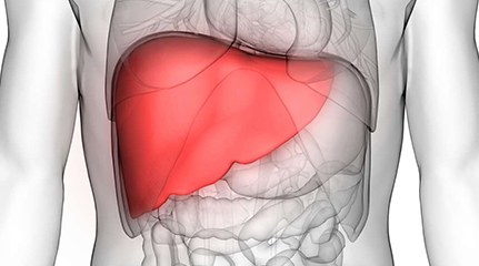 Liver Disease Management