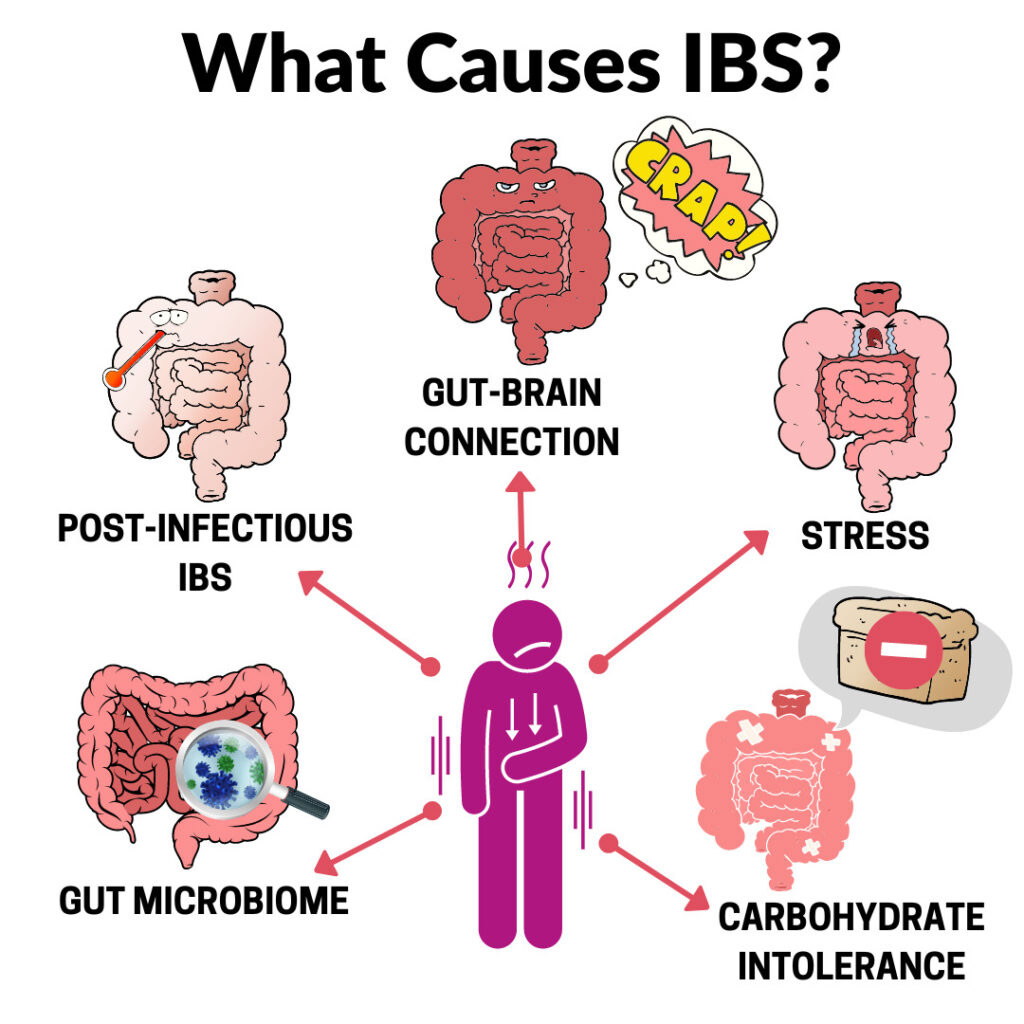 Irritable Bowel Syndrome (IBS) Treatment