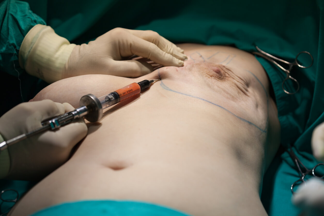 Breast Surgery