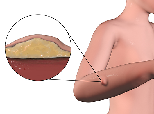 Skin and Soft Tissue Surgery