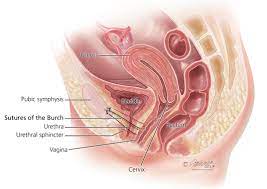 Incontinence Treatment